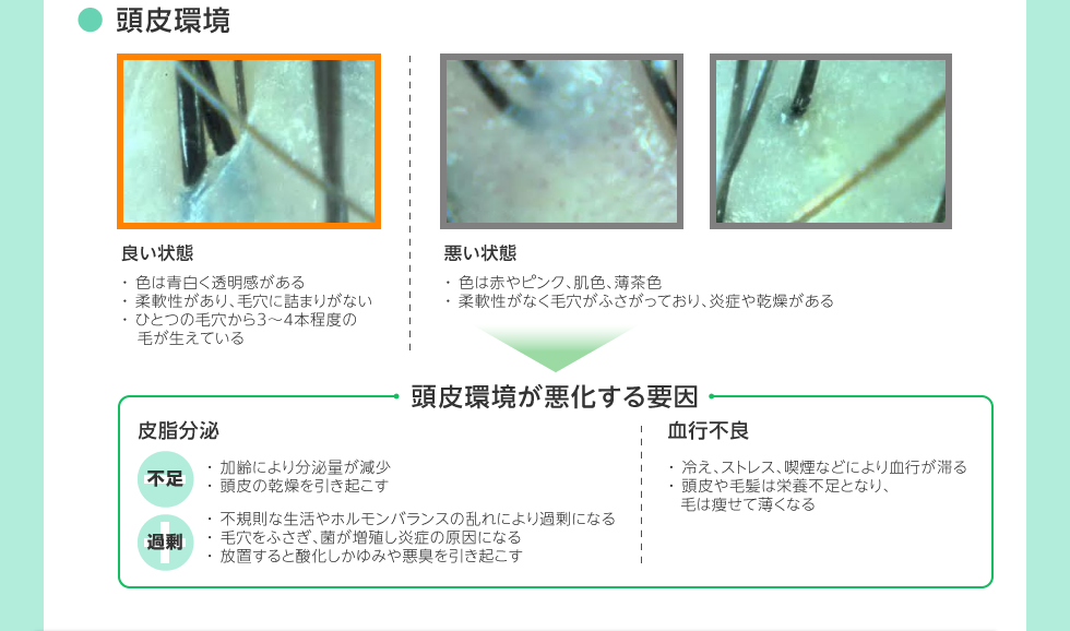 頭皮環境